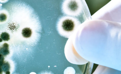 Koloniebildende Einheiten KBE Keimzahlen im Wasser